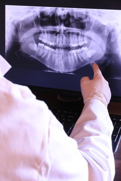 Best Broken or Chipped Tooth Repair in White Oak, MS