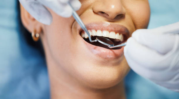 Best Emergency Dental Care for Sports Injuries in White Oak, MS