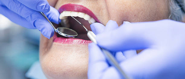 Best Emergency Root Canal Therapy in White Oak, MS