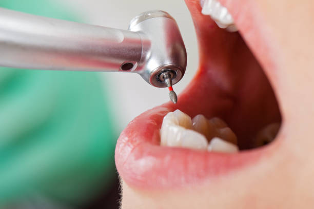  White Oak, MS Emergency Dentist Pros